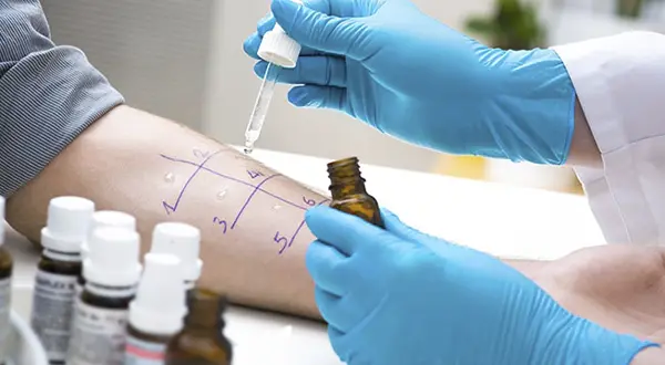 Allergy Testing Treatment